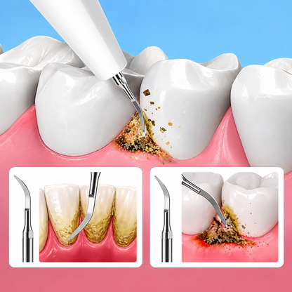 DentaShield ScalerPro™ – Pulizia ad Ultrasuoni